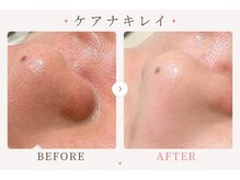 パールプラス 本庄早稲田店(Pearl plus)/毛穴汚れが浮き出る！！