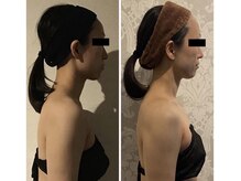 小顔フェイスラボ 春日井店(小顔 Face Labo.)/◆小顔&整体コルギで姿勢改善◆