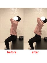 ナオル整体 福岡香椎院(NAORU整体)/30代男性施術事例【背中の張り】