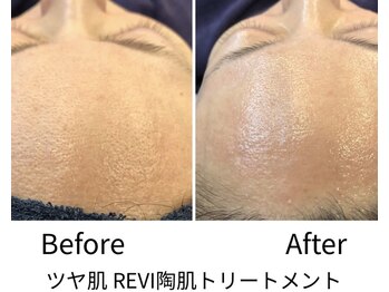 ヘルバ(HERBA)/フェイシャル