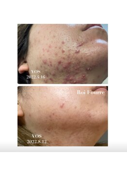 ロワフーレ/V.O.Sサロントリートメント