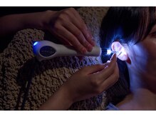 ミネル(MINELU)/MINELU-イヤーエステ-