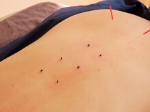 モアナ(Moana)/固い身体に