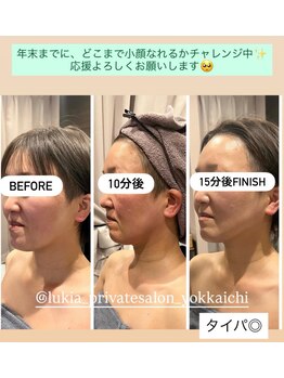 ルキア(LUKIA)/小顔施術がパワーアップ！！