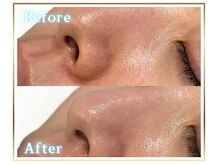 ピュアスキンサロン 恵比寿店(pure skin salon)の雰囲気(小鼻の黒ずみが一度ですっきり!)