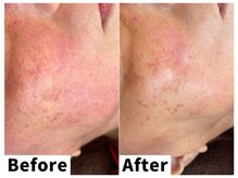 ナトゥーラ チュチュ(natura chuchu)/赤み・敏感肌ケア★大阪梅田