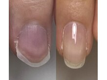 ロイヤル ネイルサロン(Royal nail Saloon)/貝爪さんの自爪育成