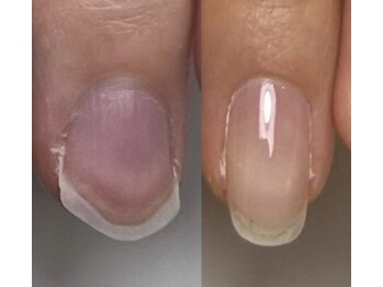 ロイヤル ネイルサロン(Royal nail Saloon)/貝爪さんの自爪育成