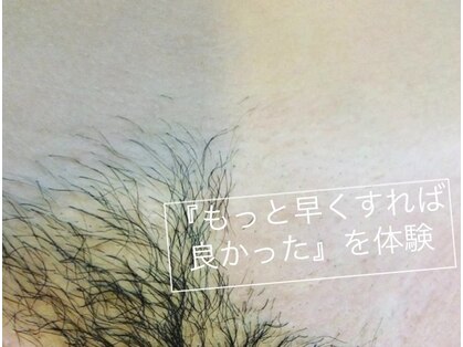 ブラジリアンワックス デボチカ(BrazilianWax DEVOCHIKA)の写真
