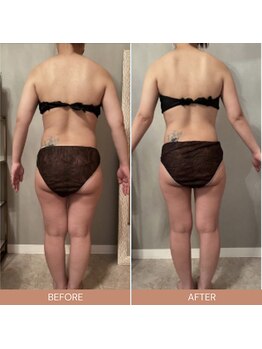 リファラ 光の森店(REFALA)/【痩身/30代女性】約3ヶ月の結果