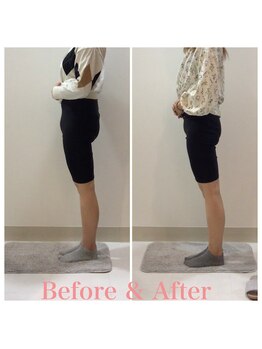 スタイルラボ高松/産後骨盤矯正の効果♪