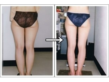 ルッチョラ(Lucciola)/ビフォーアフター