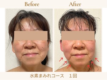 ヨサパーク ククナ 大塚(YOSA PARK kukuna)/