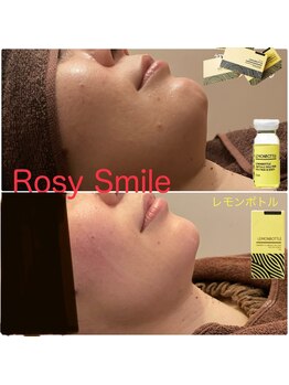 ロージースマイル(Rosy smile)/【韓国脂肪ケア LEMON BOTTLE】
