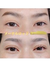 アトリエリン 小牧本店(Atelier Rin)/メーテルロッド