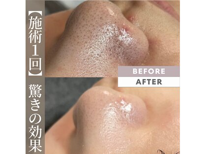 エレ(ele)の写真