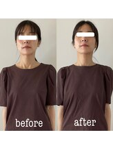 コパン ペティット(Copin Petit)/小顔整顔