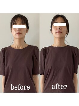 コパン ペティット(Copin Petit)/小顔整顔