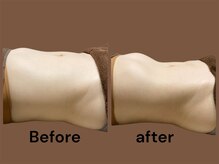 腸とVIO脱毛の専門サロン aloalo（アロアロ）/くびれ爆誕！！