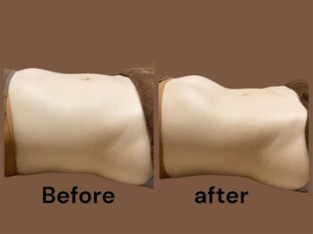 腸とVIO脱毛の専門サロン aloalo(アロアロ)/くびれ爆誕!!