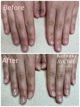 カフナ アンド チル(Kahuna&chill)/深爪矯正