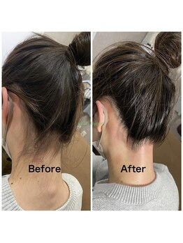 サロン ジプソ(salon Gypso.)/うなじダブル脱毛