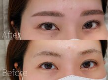 フォルミー(forume)/一番人気!眉毛まつげの同時施術