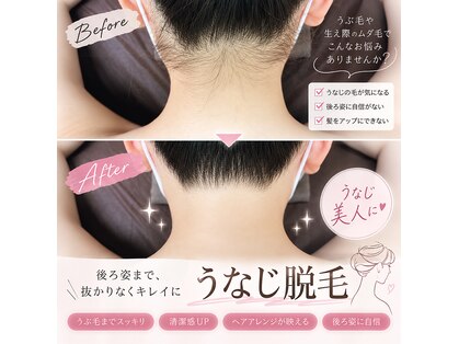 リアン(lien)の写真