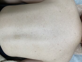 ナノハナ/鹿沼市の全身脱毛美容室ナノハナ