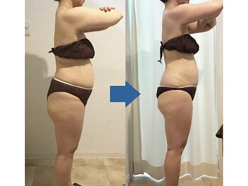 ピュアトゥルー 岐阜西店(PureTrue)/余分なお肉に高周波！ラジオ派！