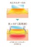 【美顔フォト】熱を与え内側から「パンッ」と肌にハリを♪シミケア年齢肌に◎