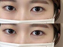 ミーアイラッシュ(ME.eyelash)/LASH LIFT
