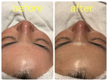 ベルドア(Bell Door)/AHAピーリング／くすみ／キメ