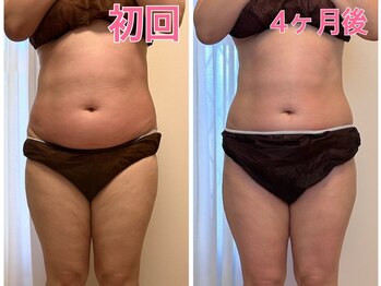 ゆずり葉/きっかけは健康診断