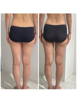 クリア(CLEAR)/整える本気のダイエット