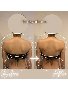 東京デトックス/バキバキ背中40分