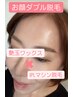 お顔ダブル脱毛！艶玉ワックス+光マシン脱毛を同時施術でピカピカ☆