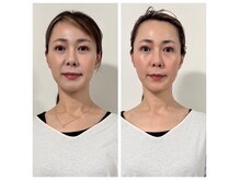 メノウ(Meknow)の雰囲気（スッキリ小顔、リフトアップが叶う小顔コルギ！）