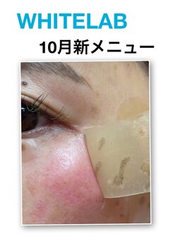 ママナ(mamana)/WHITELAB 最新シミケア