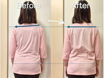 スノー シャイン(SNOW SHINE)/【Before→After】