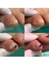 【副爪】