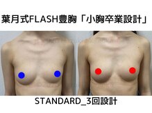 セブンシーズ 上野店(Seven Seas)/豊胸/バストアップ/東京/上野