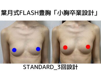 セブンシーズ 上野店(Seven Seas)/豊胸/バストアップ/東京/上野