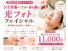 【人気No.3】大人肌改善におすすめ◆シミくすみ｜フォト光フェイシャル