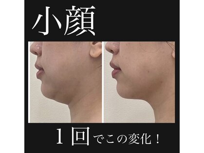 リアン 南熊本店(Lien)の写真