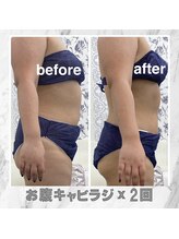 ハロ 南青山(HALO)/お腹ウエスト☆キャビラジ2回