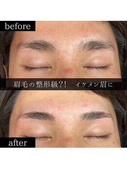 ユー 千葉駅前店(you)/ビフォーアフター写真