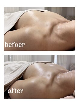 シャルマン(Charmant)/befoer.after