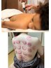 再来限定◎カッピングで深部から巡りリセット