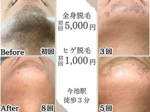 エクレ 今池店(EKURE)